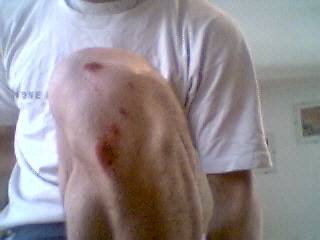 RODILLA ROTA