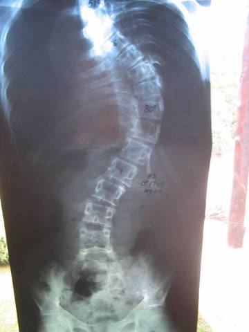 el Antes de mi columna