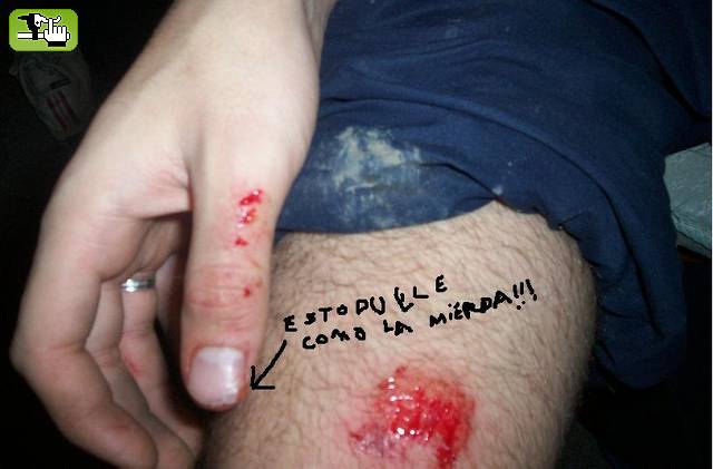 los machos se hacen sobre las bikes o cayendose de ellas jaja