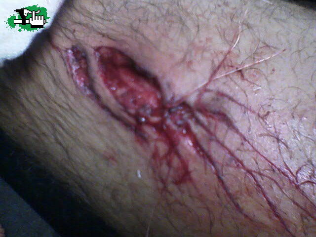 ojo con el pedal¡¡¡¡¡¡¡
