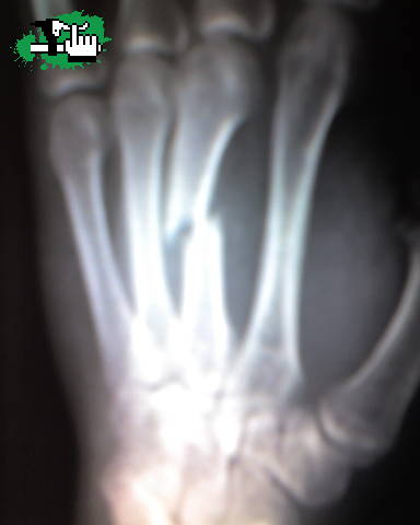 La mano de Martin!!