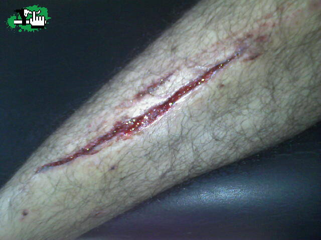 IVX, hay ke usar Proteccion!