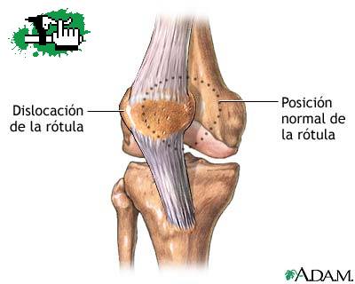 Que nunca les pase...