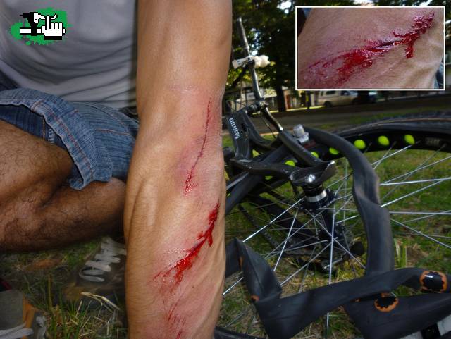 El BikeTrial duele! 