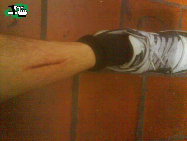 dolor dolor 