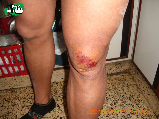Arranque fallido en Balcarce!