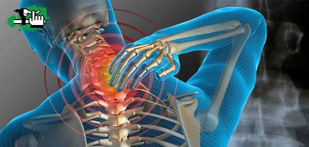dolor de cuello